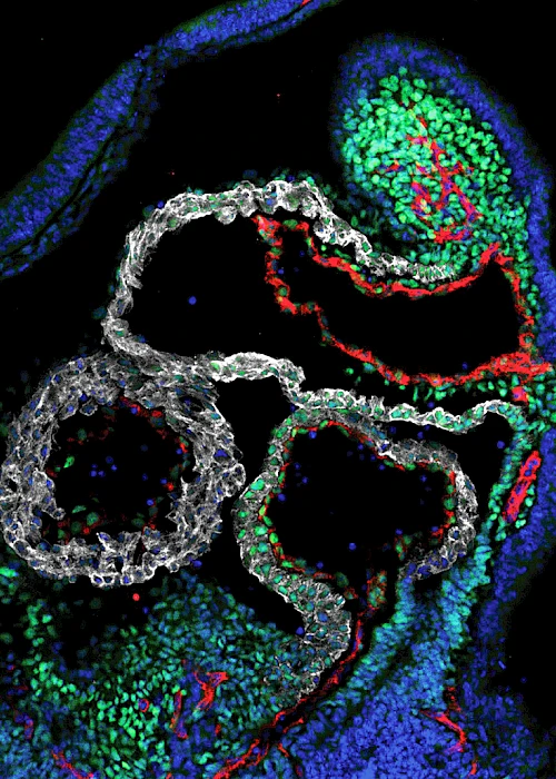 Harnessing Single-Cell Technologies to Map Cardiac Development